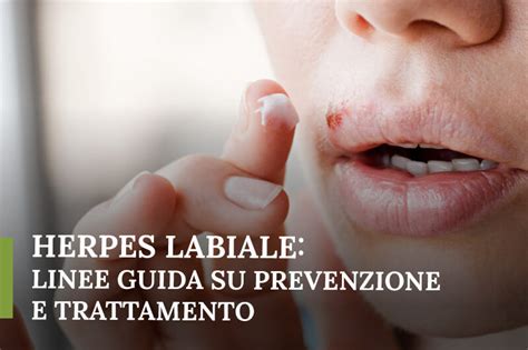 Herpes labiale: manifestazioni, complicazioni e prevenzione.